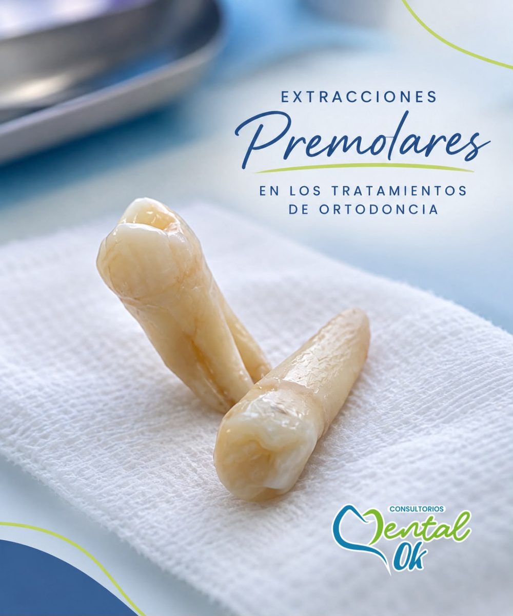 Dos premolares extraídos sobre una gasa, imagen sobre extracciones en tratamientos de ortodoncia